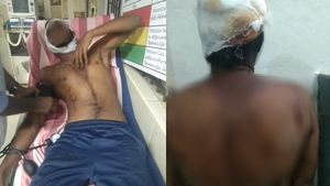 தீபாவளியிலும் தீண்டாமை.. பட்டாசு வாங்கிய தலித்-பீர் பாட்டிலால் மண்டை உடைப்பு! புதுக்கோட்டையில் பகீர்