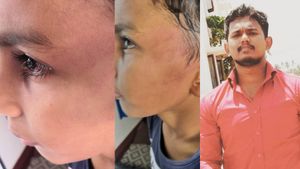 ஷூ போடாதது ஒரு குத்தமா? மதுரையில் மாணவனை காட்டுமிராண்டிதனமாக தாக்கிய பள்ளி நிர்வாகி! கண்ணில் காயம்! 