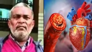 வாவ்! ஆப்ரேஷன் இல்லை.. வெறும் ஆயுர்வேத சிகிச்சை மூலம் டெல்லி இளைஞர் இதயத்தில் இருந்த அடைப்பு நீக்கம்
