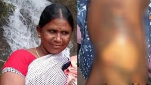 நஞ்சு  நஞ்சம்மா.. பிஞ்சுன்னு கூட பார்க்கலயே.. சித்ராவுக்கு செதில் செதிலா உரியுதே.. இவரும் ஒரு பெண்ணா