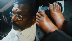  வீங்கிப்போன கால்கள்.. மிகவும் களைப்படைந்த முகம்.. திருமாவளவனை பார்த்து கலங்கும் விசிகவினர் 