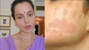 ஏர்போர்ட்டில் விழுந்த 'பளார்'.. கங்கனா கன்னத்தில் கை ரேகை பதிவாகிருக்கு.. பரவும் படம்