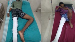  3 பேருக்கு மாவுக்கட்டு.. மதுரை நாதக நிர்வாகியை கொலை செய்தவர்களுக்கு எலும்பு முறிவு ஏற்பட்டது எப்படி?