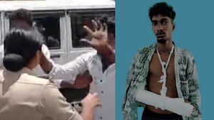 இந்த கைதானே தலை முடியை இழுத்துச்சு.. பெண் டிஎஸ்பி மீது தாக்குதல்! காளீஸ்வரனின் கையில் மாவுக் கட்டு! 