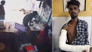 மதுரை அருகே காதலிக்க மறுத்த பெண் மீது கொலைவெறி தாக்குதல் நடத்திய இளைஞர் கைது! கையில் எலும்பு முறிவு!
