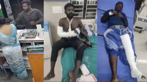 கரூர் மெடிக்கலில் தனியாக இருந்த பெண்ணிடம் செயின் பறிக்க முயன்ற இளைஞர்கள்.. கை, காலில் மாவுக்கட்டு 