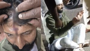 மண்டை உடைந்து வழிந்த ரத்தம்.. அண்ணாமலையின் குரு சிடி ரவிக்கு நேர்ந்த கதி.. பரபரக்கும் கர்நாடகா 