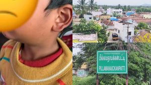ஒரே ஊரில் 100 பேருக்கு கழுத்து வீக்கம்.. MUMPS பாதிப்பு! காத்திருக்கும் ஆபத்து? அம்மை என அலட்சியம்! 