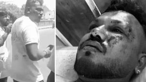 ஏர் இந்தியா விமான விபத்து.. உயிர் பிழைத்த ஒரே பயணி யார்? எந்த நாட்டை சேர்ந்தவர்?