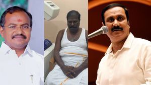 பாமக MLA-க்களுக்கு ஒரே நேரத்தில் உடல்நலக்குறைவு.. கூட்டு பிரார்த்தனை செய்வோம் எனக் கூறிய அன்புமணி!