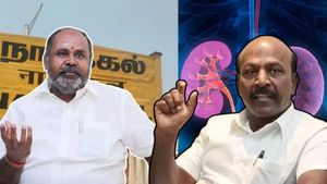 எம்.எல்.ஏ கிட்னி திருடுகிறார்..  திருட்டு இல்லை முறைகேடு என்கிறார் அமைச்சர்! விளாசிய ஆர்பி உதயகுமார்