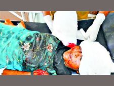 బస్సులోంచి బయటపెడితే! అమ్మాయి చేయి తెగిపడింది, తలకు తీవ్రగాయం