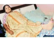 మెట్లపై నుంచి జారిపడ్డ గిడ్డి ఈశ్వరి: విరిగిన కాలు ఎముక