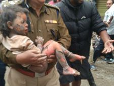 బెంగళూరులో కుప్పకూలిన భవనం: 60 శాతం కాలిపోయి మృత్యువుతో పోరాడిన చిన్నారి, చివరికి ! 