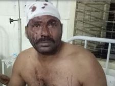 ఎమ్మెల్యే సూరి అనుచరుల వీరంగం: ‘హారన్’ కొట్టారని నలుగురిపై దాడి, తీవ్రగాయాలు