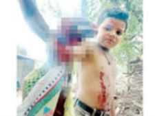 జాగ్రత్త అవసరం! చేతిలో పేలిన సెల్‌ఫోన్: తెగిపడిన బాలుడి వేళ్లు