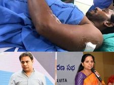 జగన్‌పై కత్తితో దాడి: కేటీఆర్, హరీశ్, కవిత, రామ్మోహన్నాయుడు, గంటా.. స్పందన