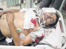 కాల్పుల కలకలం:నెల్లూరులో వ్యాపారి కాల్చివేత;నగరంలో హై అలర్ట్ ప్రకటించిన పోలీసులు