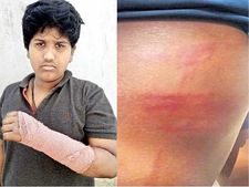 తప్పతాగి, కర్ర చేతబట్టి.. రెచ్చిపోయిన 'వాచ్‌మెన్'