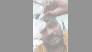 ఏపీలో వైద్య పరీక్షల తీరిదీ..? ప్లేట్‌లెట్స్ పడిపోయి యువకుడి నరకయాతన, వీడియో: చంద్రబాబు