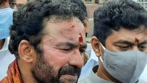 కిషన్ రెడ్డి తలకు గాయం.. కారు డోర్ తగలడంతో... నుదుటిపై కమిలిన చర్మం..