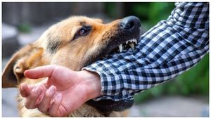 Street Dogs Attack: కంచన్ బాగ్‍లో దారుణం.. పిల్లాడిపై వీధి కుక్కల దాడి.. విషమంగా బాలుడి ఆరోగ్యం..!