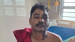 కుక్క మొరిగిందని ఆ కుక్క యజమాని మీద యాసిడ్ దాడి, మిస్టర్ జేమ్స్ ఏమిటిది?, వాడు ఏం చెప్పాడంటే! 