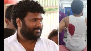  బీజేపీ నేతపై హత్యాయత్నం కేసులో బిగ్ ట్విస్ట్: తనపై తానే దాడి, ఎందుకో తెలుసా?