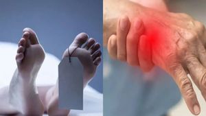 Guillain-Barre syndrome: ఏపీలో జీబీఎస్ తొలి మరణం