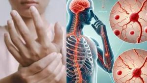 ఏపీలో జీబీఎస్ కలకలం: మరో మహిళ మృతి