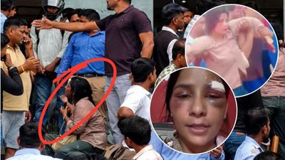 'चेहरे पर तेजाब डाल दूंगा',चोटों के निशान-सूजे चेहरे के साथ महिला ने बनाया वीडियो, सुनाई पति के करतूत की कहानी