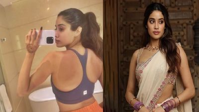 Janhvi Kapoor: जल गई जाह्नवी कपूर की पीठ, एक्ट्रेस का हुआ ऐसा हाल, बाथरूम से फोटो वायरल