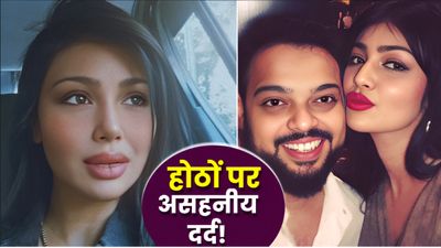 Ayesha Takia ने मुस्लिम से निकाह के बाद होठों पर सहा इतना दर्द, बदल गई सूरत, तस्वीरों ने खोला राज!
