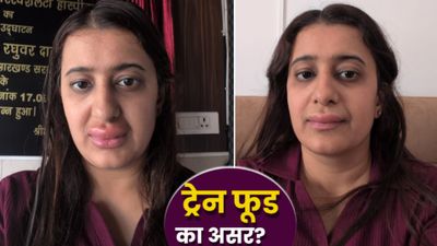 Ayushi Singh कौन हैं? Vande Bharat Train में ऐसा क्या खाया, जो भयानक सूजे होंठ? बेटा भी बीमार, कटघरे में IRCTC