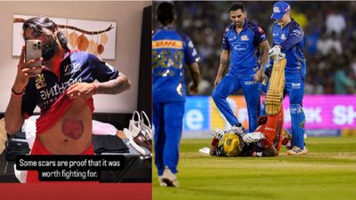 Krunal Pandya: ನೋವಿನಲ್ಲೂ ಹೋರಾಡಿದ ಕೃನಾಲ್ ಪಾಂಡ್ಯ: ವೈರಲ್ ಆಯ್ತು ಆರ್‌ಸಿಬಿ ಸ್ಟಾರ್ ಆಟಗಾರನ ಭಾವನಾತ್ಮಕ ಪೋಸ್ಟ್‌ 