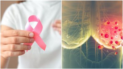 40 വയസ്സിന് താഴെയുള്ളവരിൽ ഈ മാരക ക്യാൻസർ പടരുന്നു; ഈ ലക്ഷണങ്ങൾ അവഗണിക്കരുത്