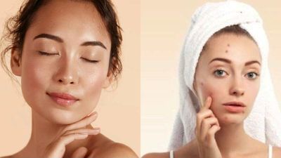 വരണ്ട ചര്‍മമാണോ? മുഖം മസാജ് ചെയ്യാന്‍ മികച്ച എണ്ണകള്‍: മുഖക്കുരുവും പേടിക്കേണ്ട