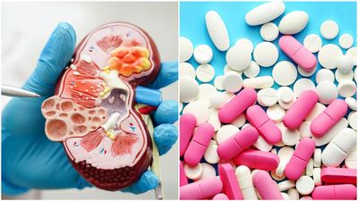 നിങ്ങൾ കഴിക്കുന്ന ഈ ഗുളികകൾ വൃക്കയെ തകർക്കും; ഡോക്ടറുടെ മുന്നറിയിപ്പ് 