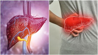 ഫാസ്റ്റ് ഫുഡ് പ്രിയരാണോ? നിങ്ങൾക്ക്  ക്യാൻസർ സാധ്യത ഇരട്ടിയെന്ന് പഠനം 