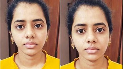 பாப்பா எப்படி இருக்கா? தந்தை கேட்டதுமே கண்கலங்கிய டாக்டர்கள்.. ஆஸ்பத்திரியில் நடந்த அந்த அதிசயம்