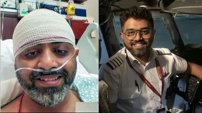 180 பேரை காப்பாற்றிய.. இந்திய பைலட்டின் மூளை பாதிக்க வாய்ப்பு.. இரண்டாக பிளந்த மண்டையோடு.. அவசர ஆபரேஷன்
