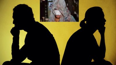 మృగంలా మారిన భర్త.. భార్య ముక్కు కొరికి.. చివరకు !!