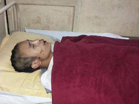 গুরগাঁও: ন্যাড়া করে নাগাল্যান্ডের ২ কিশোরকে নির্মম মার দুষ্কৃতীদের