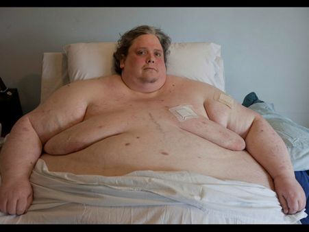 প্রয়াত হলেন বিশ্বের স্থূলতম মানুষ