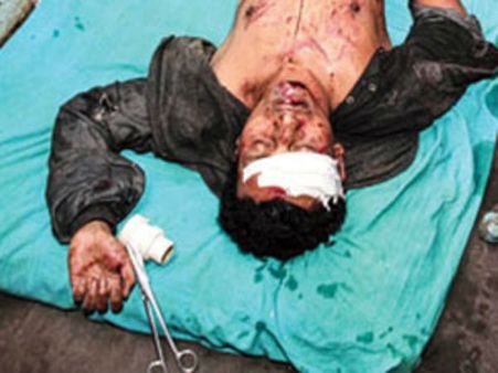 অভিষেককে চড় মারায় খুনের চেষ্টার মামলা দেবাশিস আচার্যর বিরুদ্ধে!