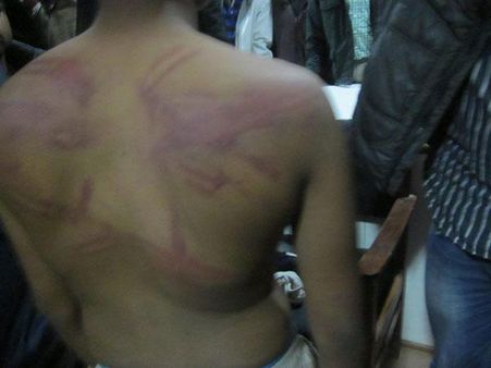 ঋণের বকেয়া টাকা ফেরত চাওয়ায় দৃষ্টিহীন অ্যাথলিটকে বেদম মারধর