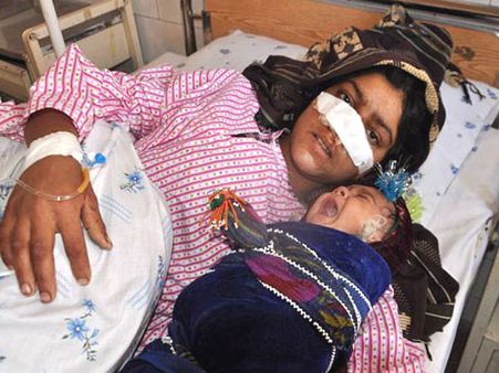 সাত বছর বয়স দ্বিতীয় স্ত্রীর, সতীনের বিরোধিতা করায় প্রথম স্ত্রীর নাক কাটল স্বামী