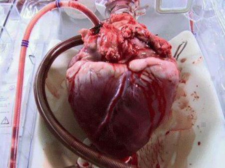 রাস্তার মাঝেই কেউ ফেলে গিয়েছে 'তাজা হৃৎপিণ্ড', কী করবে বুঝে পারছে না পুলিশও!