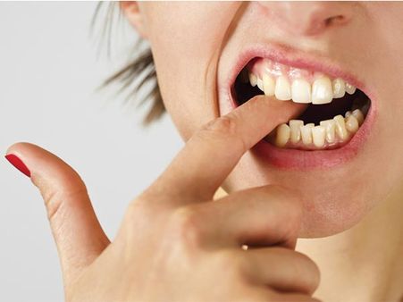 বউয়ের কামড়ে বেঘোরে প্রাণ গেল বরের