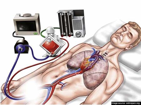 জয়াকে যে যন্ত্র বাঁচাতে পারেনি, তার প্রয়োগে মাত্র কয়েকদিনে সুস্থ মৃতপ্রায় শ্রীনাথ